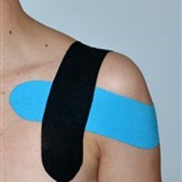 Tejpování – stabilizace ramenního kloubu